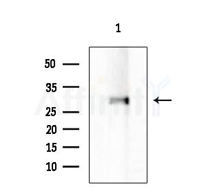 IgG1 Antibody - Western blot analysis of extracts from HUVEC cells, using IgG1 Antibody at 1/1000 dilution.