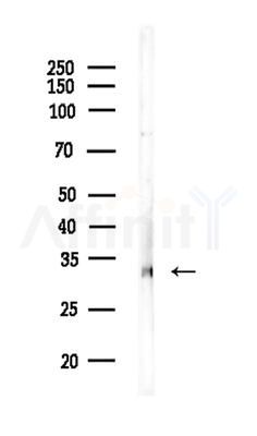 IgG1 Antibody - Western blot analysis of lysates from HUVEC cells, using IgG1 Antibody at 1/1000 dilution.