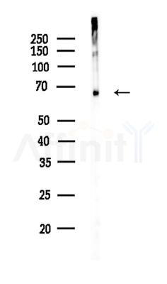NETO2 Antibody - Western blot analysis of lysates from Mouse brain, using NETO2 Antibody at 1/1000 dilution.