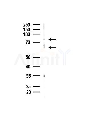 SENP3 Antibody - Western blot analysis of lysates from MDA-MB-231 cells(heat-shock,45min treatment), using SENP3 Antibody at 1/1000 dilution.