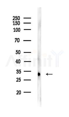 OSR1 Antibody - Western blot analysis of lysates from HUVEC cells, using OSR1 Antibody at 1/1000 dilution.