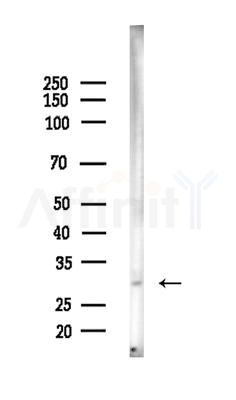 CD48 Antibody - Western blot analysis of lysates from EC304 cells, using CD48 Antibody at 1/1000 dilution.