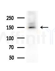 HDLBP Antibody - Western blot analysis of extracts from Rat brain, using HDLBP Antibody at 1/1000 dilution.