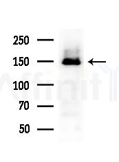 HDLBP Antibody - Western blot analysis of extracts from B16F10-LUC cells(UV,30min treatment), using HDLBP Antibody at 1/1000 dilution.