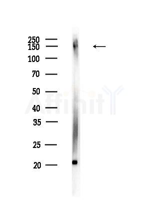 HDLBP Antibody - Western blot analysis of lysates from B16F10-LUC cells(UV,30min treatment), using HDLBP Antibody at 1/1000 dilution.