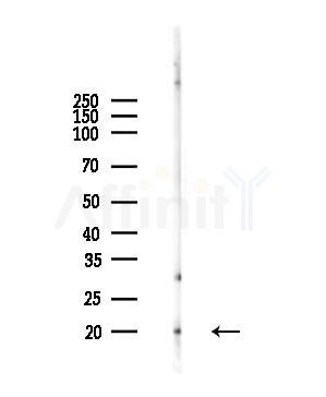 TSPO Antibody - Western blot analysis of lysates from Mouse liver, using TSPO Antibody at 1/1000 dilution.