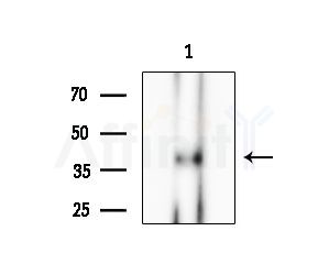 TRAM2 Antibody - Western blot analysis of extracts from Rat 丸, using TRAM2 Antibody at 1/1000 dilution.