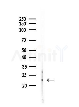 UBE2M Antibody - Western blot analysis of lysates from PC12 cells(LPS, 4h treatment), using UBE2M Antibody at 1/1000 dilution.