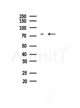 OS9 Antibody - Western blot analysis of lysates from COLO205 cells, using OS9 Antibody at 1/1000 dilution.