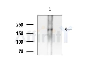 PPP1R9A Antibody - Western blot analysis of extracts from Mouse brain, using PPP1R9A Antibody at 1/1000 dilution.