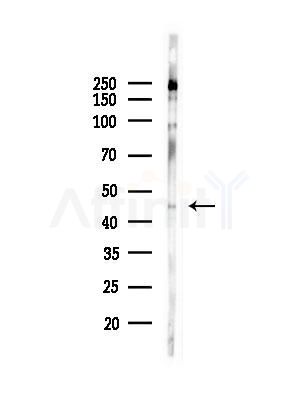 MAPKAPK2 Antibody - Western blot analysis of lysates from COLO205 cells(heat-shock,45min treatment), using MAPKAPK2 Antibody at 1/1000 dilution.