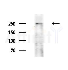 Factor V Antibody - Western blot analysis of lysates from A375 cells(starvation,24h treatment), using Factor V Antibody at 1/1000 dilution.