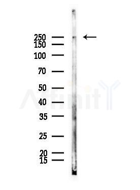 Factor V Antibody - Western blot analysis of lysates from A375 cells(starvation,24h treatment), using Factor V Antibody at 1/1000 dilution.
