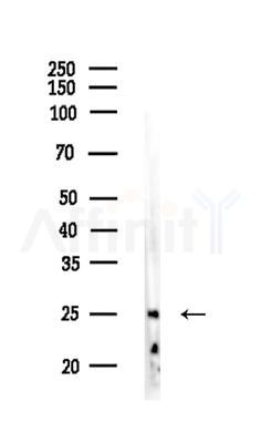 PSMA7 Antibody - Western blot analysis of lysates from Mouse liver, using PSMA7 Antibody at 1/1000 dilution.