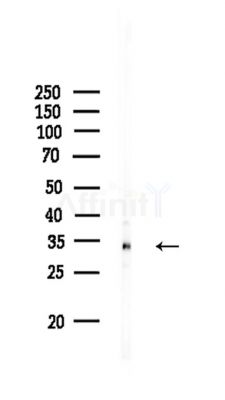 CDC123 Antibody - Western blot analysis of lysates from Rat liver, using CDC123 Antibody at 1/1000 dilution.