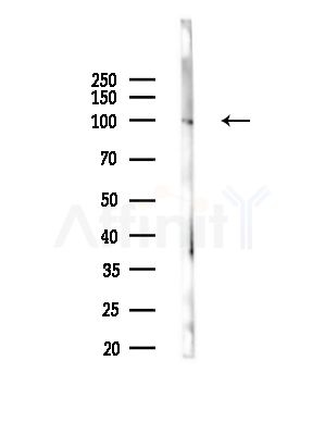 KIFAP3 Antibody - Western blot analysis of lysates from Hela cells, using KIFAP3 Antibody at 1/1000 dilution.