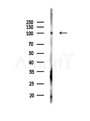 KIFAP3 Antibody - Western blot analysis of lysates from COLO205 cells, using KIFAP3 Antibody at 1/1000 dilution.