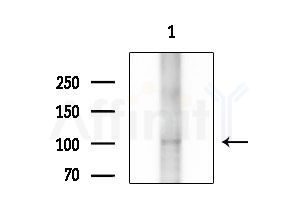 TNPO3 Antibody - Western blot analysis of extracts from B16F10-LUC cells(heat-shock treatment), using TNPO3 Antibody at 1/1000 dilution.