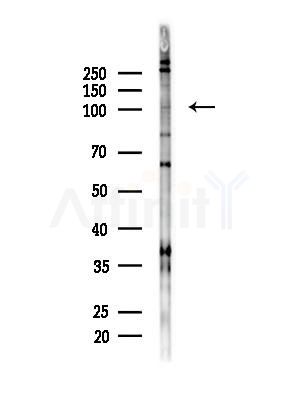 TNPO3 Antibody - Western blot analysis of lysates from B16F10-LUC cells(heat-shock,45min treatment), using TNPO3 Antibody at 1/1000 dilution.