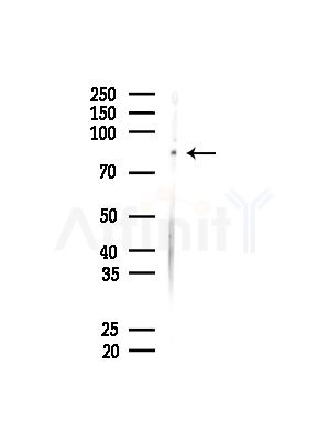 DCLK1 Antibody - Western blot analysis of lysates from MDA-MB-231 cells(heat-shock,45min treatment), using DCLK1 Antibody at 1/1000 dilution.
