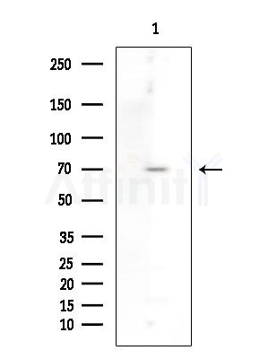 PKP3 Antibody - Western blot analysis of extracts from B16F10-LUC cells(UV 30min treatment), using PKP3 Antibody at 1/1000 dilution.