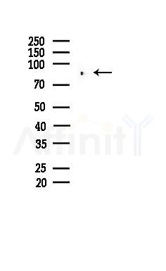 PKP3 Antibody - Western blot analysis of lysates from B16F10-LUC cells(UV,30min treatment), using PKP3 Antibody at 1/1000 dilution.