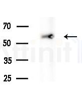 TXNRD1 Antibody - Western blot analysis of extracts from Mouse testis, using TXNRD1 Antibody at 1/1000 dilution.