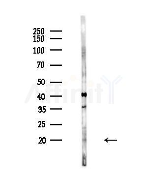 IL22 Antibody - Western blot analysis of lysates from 293 cells(starvation,24h treatment), using IL22 Antibody at 1/1000 dilution.
