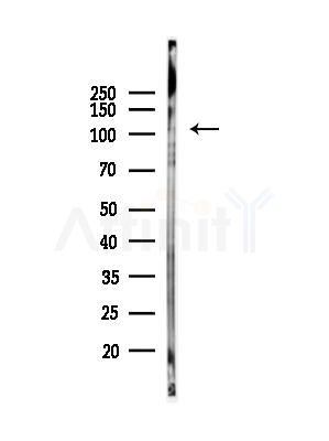 ERAP1 Antibody - Western blot analysis of lysates from B16F10-LUC cells(heat-shock,45min treatment), using ERAP1 Antibody at 1/1000 dilution.