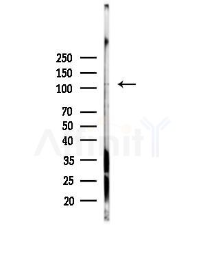ERAP1 Antibody - Western blot analysis of lysates from Hela cells(heat-shock,45min treatment), using ERAP1 Antibody at 1/1000 dilution.