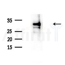 DCTN3 Antibody - Western blot analysis of extracts from B16F10-LUC cells(heat-shock treatment), using DCTN3 Antibody at 1/1000 dilution.