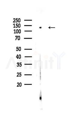PLCB3 Antibody - Western blot analysis of lysates from EC304 cells, using PLCB3 Antibody at 1/1000 dilution.