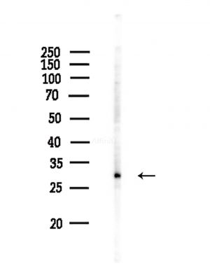 C1QTNF2 Antibody - Western blot analysis of lysates from COLO205 cells(heat-shock,45min treatment), using C1QTNF2 Antibody at 1/1000 dilution.