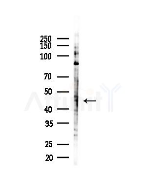 DUX4 Antibody - Western blot analysis of lysates from COLO205 cells(heat-shock,45min treatment), using DUX4 Antibody at 1/1000 dilution.