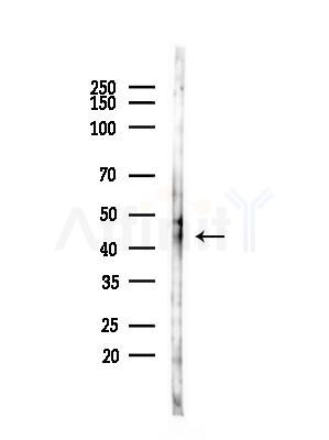 LHX3 Antibody - Western blot analysis of lysates from COLO205 cells(heat-shock,45min treatment), using LHX3 Antibody at 1/1000 dilution.