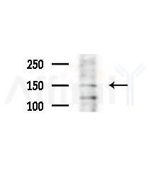 WRN Antibody - Western blot analysis of extracts from COLO205 cells(heat-shock,45min treatment), using WRN Antibody at 1/1000 dilution.