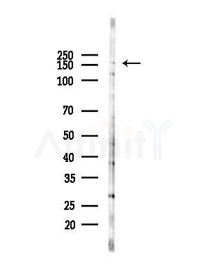 WRN Antibody - Western blot analysis of lysates from COLO205 cells(heat-shock,45min treatment), using WRN Antibody at 1/1000 dilution.