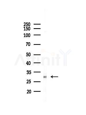 COPS7B Antibody - Western blot analysis of lysates from B16F10-LUC cells(heat-shock,45min treatment), using COPS7B Antibody at 1/1000 dilution.