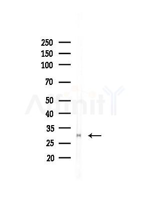 COPS7B Antibody - Western blot analysis of lysates from Hela cells(heat-shock,45min treatment), using COPS7B Antibody at 1/1000 dilution.