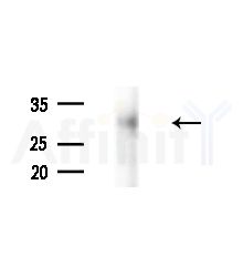 SRD5A2 Antibody - Western blot analysis of extracts from EC304 cells(heat-shock,45min treatment), using SRD5A2 Antibody at 1/1000 dilution.