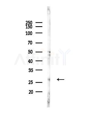 SRD5A2 Antibody - Western blot analysis of lysates from EC304 cells(heat-shock,45min treatment), using SRD5A2 Antibody at 1/1000 dilution.