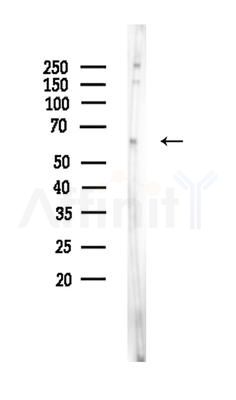 ICOSLG Antibody - Western blot analysis of lysates from EC304 cells, using ICOSLG Antibody at 1/1000 dilution.
