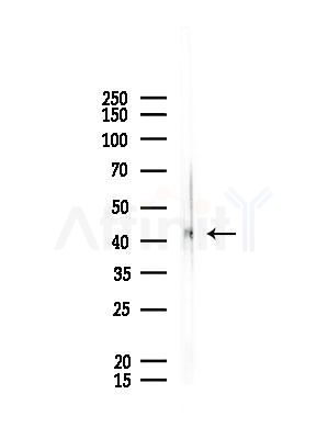 TSG101 Antibody - Western blot analysis of lysates from Rat lung, using TSG101 Antibody at 1/1000 dilution.