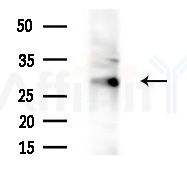 GNRHR Antibody - Western blot analysis of extracts from HepG2 cells(starvation,24h treatment), using GNRHR Antibody at 1/1000 dilution.