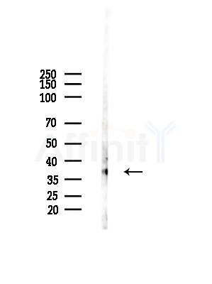 GNRHR Antibody - Western blot analysis of lysates from HepG2 cells(starvation,24h treatment), using GNRHR Antibody at 1/1000 dilution.