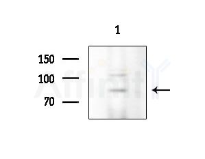 MSP/MST1 Antibody - Western blot analysis of extracts from COLO205 cells, using MSP/MST1 Antibody at 1/1000 dilution.