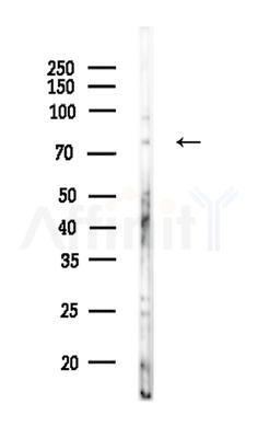 MSP/MST1 Antibody - Western blot analysis of lysates from COLO205 cells, using MSP/MST1 Antibody at 1/1000 dilution.