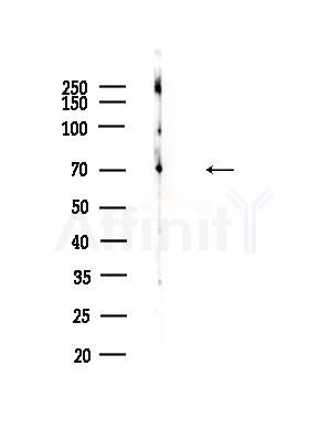 CD300A Antibody - Western blot analysis of lysates from 3T3-L1 P6(heat-shock,45min treatment), using CD300A Antibody at 1/1000 dilution.