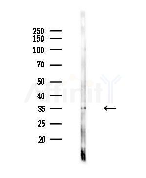 MGLL Antibody - Western blot analysis of lysates from 293 cells(starvation,24h treatment), using MGLL Antibody at 1/1000 dilution.
