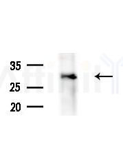 CLPP Antibody - Western blot analysis of extracts from various samples, using CLPP Antibody at 1/1000 dilution.